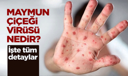 Maymun Çiçeği virüsü nedir?