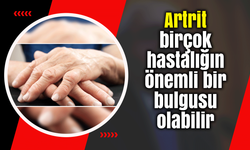 Artrit birçok hastalığın önemli bir bulgusu olabilir