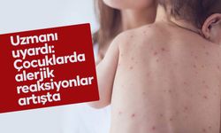 Uzmanı uyardı: Çocuklarda alerjik reaksiyonlar artışta