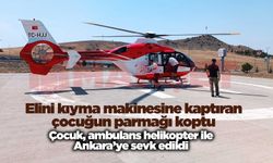 Elini kıyma makinesine kaptıran çocuğun parmağı koptu