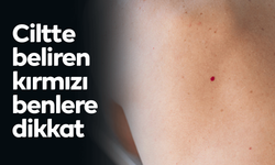 Ciltte beliren kırmızı benlere dikkat