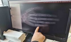 Eskişehir'de her ay 5 ila 7 çocuğa kanser tanısı konuluyor