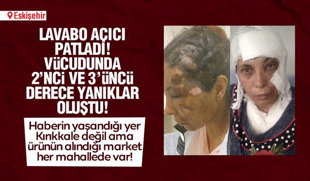 BİM'den aldığı lavabo açıcısı yüzüne patladı! 2'nci ve 3'üncü derece yanıklar oluştu!