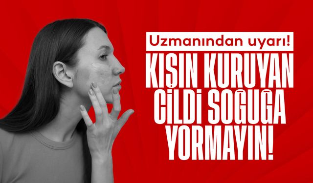 Uzmanından uyarı! 'Kışın kuruyan cildi soğuğa yormayın'