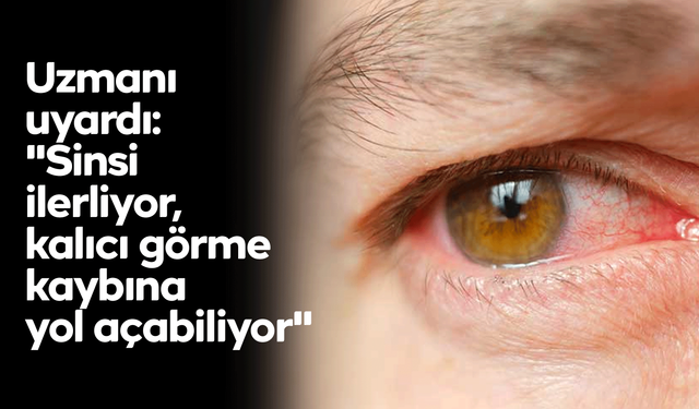 Uzmanı uyardı: "Sinsi ilerliyor, kalıcı görme kaybına yol açabiliyor"
