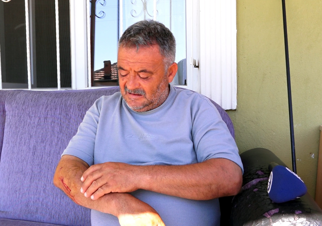 Kırıkkale'de Başıboş Köpeklerin Yaraladığı Vatandaş, Yaşadıklarını Anlattı (1)